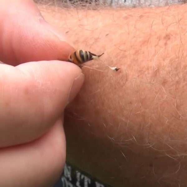 Stings Must Not Be Taken Lightly, Beekeeper Warns
